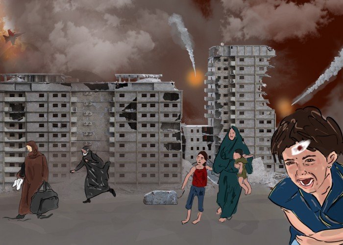 من العدوان إلى الشفاء: قصة التعافي من آثار القصف