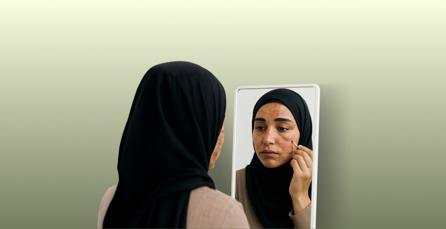 على خارطة أجسادهن ندوب لا تُمحى